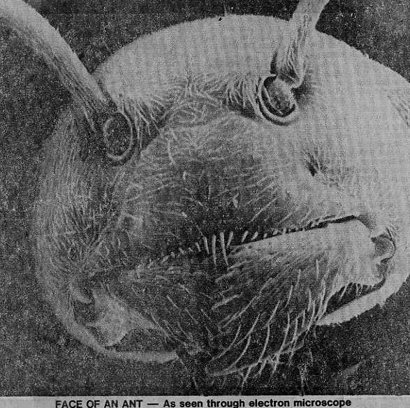 Фаца на мравка, гледана под електронски микроскоп
