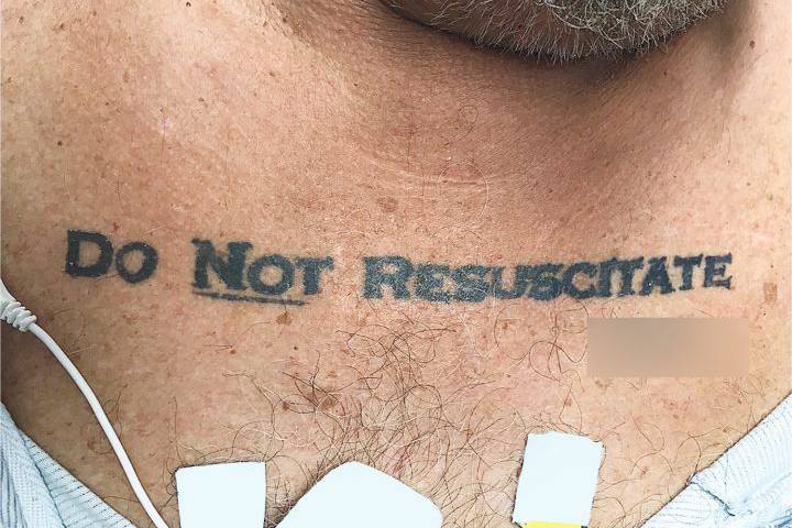 Пациентот што докторите го оставија да умре поради тетоважа