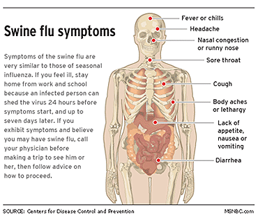 swine_flu_symptoms_370